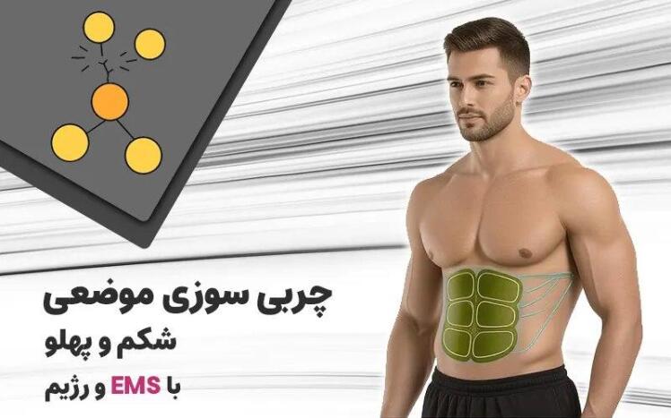 چربی سوزی موضعی شکم و پهلو با EMS و رژیم